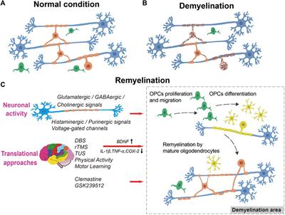 Neuronal activity and remyelination: new insights into the molecular mechanisms and therapeutic advancements